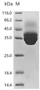 Recombinant Human Tissue factor (F3), partial