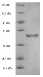 Recombinant Human Coagulation factor V (F5), partial, Homo sapiens (Human), E.coli, N-terminal 6xHis-SUMO-tagged, 30.4kDa, purity >90% as determined by SDS-PAGE.