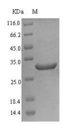 Recombinant Human Acyl-CoA 6-desaturase (FADS2), partial