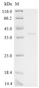 Recombinant Human FERM, ARHGEF and pleckstrin domain-containing protein 2 (FARP2), partial