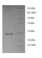 Recombinant Human Tumor necrosis factor ligand superfamily member 6 (FASLG), partial, Homo sapiens (Human), E.coli, N-terminal 6xHis-tagged, 24.4kDa, purity >90% as determined by SDS-PAGE.