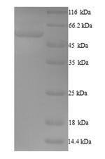 Recombinant Human F-box only protein 3 (FBXO3)