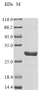 Recombinant Human F-box only protein 48 (FBXO48)