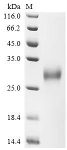 Recombinant Human Low affinity immunoglobulin gamma Fc region receptor II-a (FCGR2A), partial (Active)