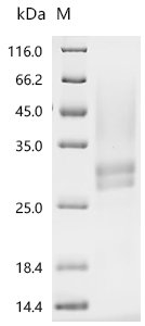 Recombinant Human Low affinity immunoglobulin gamma Fc region receptor II-a (FCGR2A), partial, Homo sapiens (Human), Yeast, N-terminal 6xHis-tagged, 22.4kDa, purity >95% as determined by SDS-PAGE.
