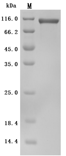 Recombinant Human Low affinity immunoglobulin gamma Fc region receptor III-A (FCGR3A) (F176V), partial (Active)