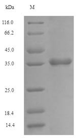 Recombinant Human Fc receptor-like protein 6 (FCRL6), partial
