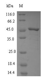 Recombinant Human Squalene synthase (FDFT1), partial, Homo sapiens (Human), E.coli, N-terminal 6xHis-tagged, 52.0kDa, purity >90% as determined by SDS-PAGE.
