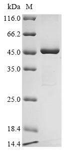 Recombinant Human Ferrochelatase, mitochondrial (FECH), Homo sapiens (Human), E.coli, N-terminal 10xHis-tagged and C-terminal Myc-tagged, 49.6kDa, purity >90% as determined by SDS-PAGE.