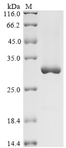 Recombinant Human Tyrosine-protein kinase Fer (FER), partial