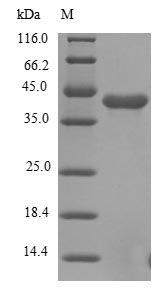 Recombinant Human Fibroblast growth factor receptor 1 (FGFR1), partial
