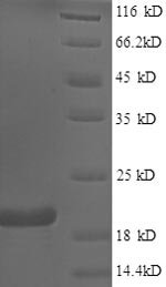 Recombinant Human Bis (5'-adenosyl)-triphosphatase (FHIT), Homo sapiens (Human), E.coli, N-terminal 6xHis-tagged, 20.7kDa, purity >90% as determined by SDS-PAGE.