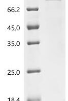 (Tris-Glycine gel) Discontinuous SDS-PAGE (reduced) with 5% enrichment gel and 15% separation gel.