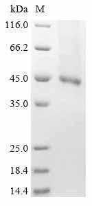 Recombinant Human Receptor-type tyrosine-protein kinase FLT3 (FLT3), partial, Homo sapiens (Human), Baculovirus, C-terminal 6xHis-tagged, 48.5kDa, purity >85% as determined by SDS-PAGE.