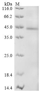 Recombinant Human Receptor-type tyrosine-protein kinase FLT3 (FLT3), partial, Homo sapiens (Human), Baculovirus, N-terminal 6xHis-tagged, 48.5kDa, purity >90% as determined by SDS-PAGE.