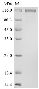 Recombinant Human Vascular endothelial growth factor receptor 3 (FLT4), partial, Biotinylated, Homo sapiens (Human), Mammalian cell, C-terminal 10xHis-Avi-tagged, 89.1kDa, purity >90% as determined by SDS-PAGE.