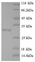 Recombinant Human Forkhead box protein P3 (FOXP3), partial