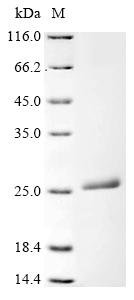 Recombinant Human Ferritin light chain (FTL)