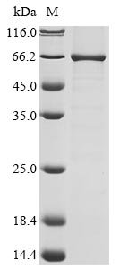 Recombinant Human Alpha-ketoglutarate-dependent dioxygenase FTO (FTO)