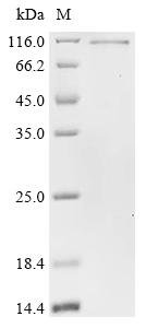 Recombinant Human Fragile X mental retardation syndrome-related protein 1 (FXR1), Homo sapiens (Human), E.coli, N-terminal GFP-tagged and C-terminal 6xHis-tagged, 97.7kDa, purity >90% as determined by SDS-PAGE.