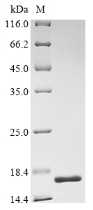 Recombinant Human Fragile X mental retardation syndrome-related protein 1 (FXR1), partial, Homo sapiens (Human), E.coli, C-terminal 6xHis-tagged, 15.6kDa, purity >90% as determined by SDS-PAGE.