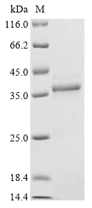 Recombinant Human Fragile X mental retardation syndrome-related protein 1 (FXR1), partial, Homo sapiens (Human), E.coli, C-terminal 6xHis-tagged, 30.7kDa, purity >85% as determined by SDS-PAGE.