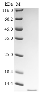 Recombinant Human Fragile X mental retardation syndrome-related protein 1 (FXR1), partial, Homo sapiens (Human), E.coli, C-terminal 6xHis-tagged, 9.8kDa, purity >90% as determined by SDS-PAGE.