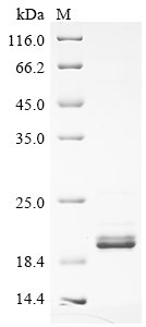 Recombinant Human Glucose-6-phosphatase catalytic subunit 1 (G6PC1), partial