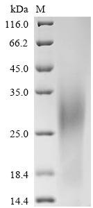 Recombinant Human Glucose-6-phosphatase catalytic subunit 1 (G6PC1), partial, Homo sapiens (Human), Yeast, C-terminal 6xHis-tagged, 5.6kDa, purity >85% as determined by SDS-PAGE.