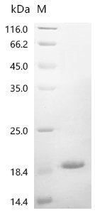 Recombinant Human Gamma-aminobutyric acid receptor-associated protein-like 1 (GABARAPL1), Homo sapiens (Human), E.coli, C-terminal 6xHis-tagged, 14.9kDa, purity >85% as determined by SDS-PAGE.