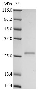 Recombinant Human G antigen 7 (GAGE7)