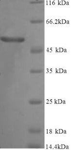 Recombinant Human Vitamin D-binding protein (GC), partial