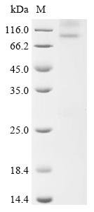 Recombinant Cavia porcellus Potassium voltage-gated channel subfamily KQT member 1 (KCNQ1) Protein, Cavia porcellus (Guinea pig), in vitro E.coli expression system, N-terminal 10xHis-tagged, 80.5kDa, purity >85% as determined by SDS-PAGE.