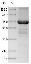 Recombinant Human Growth hormone receptor (GHR), partial