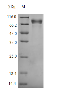 Recombinant Human Growth hormone receptor (GHR), partial, Biotinylated (Active), Homo sapiens (Human), Mammalian cell, C-terminal mFc-Avi-tagged, 56.6kDa, purity >95% as determined by SDS-PAGE.