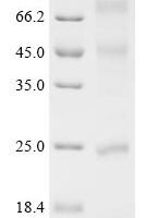 (Tris-Glycine gel) Discontinuous SDS-PAGE (reduced) with 5% enrichment gel and 15% separation gel.