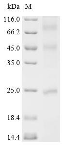 Recombinant Staphylococcus aureus CDP-diacylglycerol--glycerol-3-phosphate 3-phosphatidyltransferase (pgsA) Protein, Staphylococcus aureus (strain MW2), in vitro E.coli expression system, N-terminal 10xHis-tagged, 27.1kDa, purity >85% as determined by SDS-PAGE.