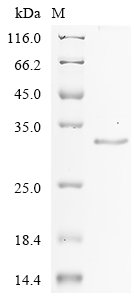 Recombinant Human Gastrokine-1 (GKN1)