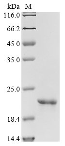 Recombinant Human Gastrokine-1 (GKN1), partial
