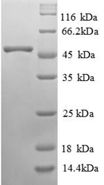 Recombinant Human Alpha-galactosidase A (GLA)