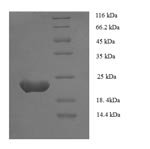 Recombinant Human Zinc finger protein GLI1 (GLI1), partial