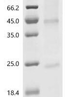 (Tris-Glycine gel) Discontinuous SDS-PAGE (reduced) with 5% enrichment gel and 15% separation gel.