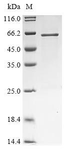 Recombinant Human Protein GOLM2 (GOLM2), partial