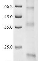 (Tris-Glycine gel) Discontinuous SDS-PAGE (reduced) with 5% enrichment gel and 15% separation gel.