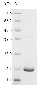 Recombinant Human Platelet glycoprotein Ib beta chain (GP1BB), partial