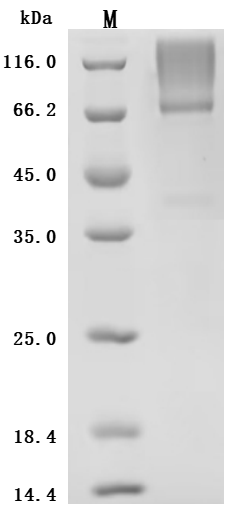 Recombinant Human Glypican-3 (GPC3) (S359F), partial (Active), Homo sapiens (Human), Mammalian cell, C-terminal 10xHis-tagged, 62.2kDa, purity >90% as determined by SDS-PAGE.