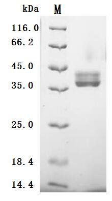 Recombinant Human Glypican-3 (GPC3), partial (Active), Homo sapiens (Human), Mammalian cell, N-terminal mFc-tagged, 32.1kDa, purity >95% as determined by SDS-PAGE.