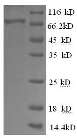 Recombinant Human Glucose-6-phosphate isomerase (GPI), partial
