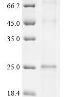 (Tris-Glycine gel) Discontinuous SDS-PAGE (reduced) with 5% enrichment gel and 15% separation gel.