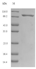 Recombinant Human Gasdermin-C (GSDMC)